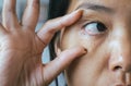 Veins on red eye asian woman,Eyelid layer,Causes the use of eyes and not enough rest Royalty Free Stock Photo