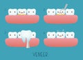 Veneer tooth of dental Royalty Free Stock Photo