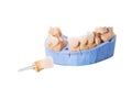 Veneers and crowns isolated on white background. Plaster model of teeth. lower jaw plaster model with prepared teeth