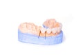 Veneers and crowns isolated on white background. Plaster model of teeth. lower jaw plaster model with prepared teeth