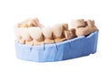 Veneers and crowns isolated on white background. Plaster model of teeth. lower jaw plaster model with prepared teeth