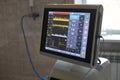 The ventilator during operation. The monitor shows the settings. Close-up