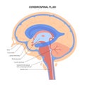 Ventricular system concept