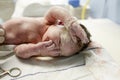Vernix covered newborn after delivery