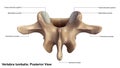 Vertebra lumbalis_Posterior view