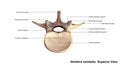 Vertebra lumbalis_Superior view