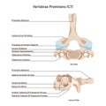 Vertebra prominens. Anatomy of the 7th cervical vertebra. C7. Royalty Free Stock Photo