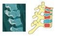 Vertebrae