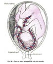 Vertical anatomy drawing and text, of the fetus in utero, betwe from the 19th-century Royalty Free Stock Photo