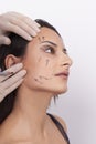 Vertical closeup shot of a woman preparing her face for a plastic surgery  procedure  professional Royalty Free Stock Photo