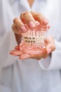 Vertical detail cropped shot of unrecognizable female orthodontist doctor in white coat holding human jaws layout model