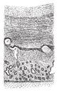 Vertical section through the pseudomembrane, vintage engraving