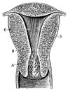 Vertical section through the uterus of a woman who has given birth.