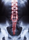 Vertical shot of thespine and pelvis of a human body on x-ray Royalty Free Stock Photo