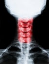 Vertical shot of an X-ray image of the neck and cervical spine Royalty Free Stock Photo