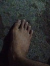 very ugly feet And so dirty