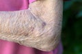 Very wrinkled arm and elbow of an old person