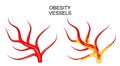 Vessels healthy and obese Royalty Free Stock Photo