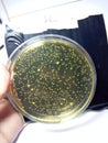 Vibrio bacterial with yellow colony in the TCBS agar