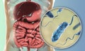 Vibrio cholerae bacteria in small intestine Royalty Free Stock Photo