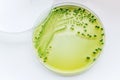 Vibrio parahaemolyticus: Gram-negative, Royalty Free Stock Photo