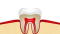 video animation of pulsation of sensitive tooth enamel