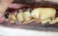 View ino the mouth of an elder dog. The roots of the upper molar to the left are rotten, this tooth needs to be drawn