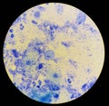 View in the microscope on Trichomonas painted with methylene blue, cytological smear Royalty Free Stock Photo