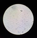 View in the microscope on Trichomonas STD Royalty Free Stock Photo