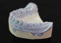 View of plaster model of lower front teeth Royalty Free Stock Photo