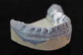 View of plaster model of lower front teeth Royalty Free Stock Photo