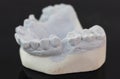 View of plaster model of lower front teeth Royalty Free Stock Photo