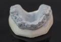 View of plaster model of lower front teeth Royalty Free Stock Photo