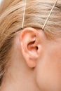 View of young woman with golden hairpins