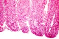 Villi of small intestine, light micrograph