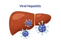 Viral hepatitis, damages liver and viruses vector flat illustration isolated on white background. Royalty Free Stock Photo