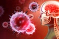 Virus or bacteria attacking the human brain