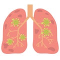 Virus or bacterial infects lungs.virus invades lungs Royalty Free Stock Photo