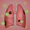 Virus cells eating lung. Virus cells biting lung. Damaged lung Royalty Free Stock Photo