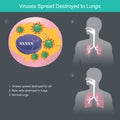 Virus spread destroyed to lungs, Illustration show different the lungs human from CORONAVIRUSES Royalty Free Stock Photo