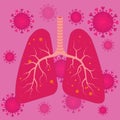 Viruses and bacteria infect Human lungs. lung disease. vector Royalty Free Stock Photo