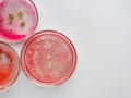 Viruses and bacteria in a Petri dish, studying the growth of bacteria on different samples in the laboratory. Royalty Free Stock Photo