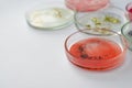 Viruses and bacteria in a Petri dish, studying the growth of bacteria on different samples in the laboratory. Royalty Free Stock Photo