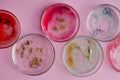 Viruses and bacteria in a Petri dish, various analyses in the laboratory.