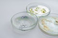 Viruses and bacteria in a Petri dish, various analyses in the laboratory.