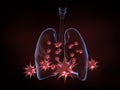 Viruses on lungs, Coronavirus attack lung.