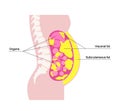 Visceral fat diagram