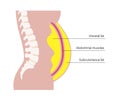 Visceral fat diagram