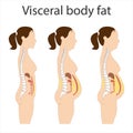 Visceral fat and subcutaneous fat accumulate around organs