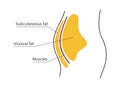 Visceral and subcutaneous fat around waistline. Location of visceral fat in abdominal cavity. Types of human obesity